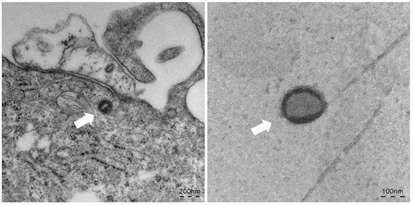원숭이두창 바이러스 한국분리주 전자 현미경 사진. [질병관리청 제공]
